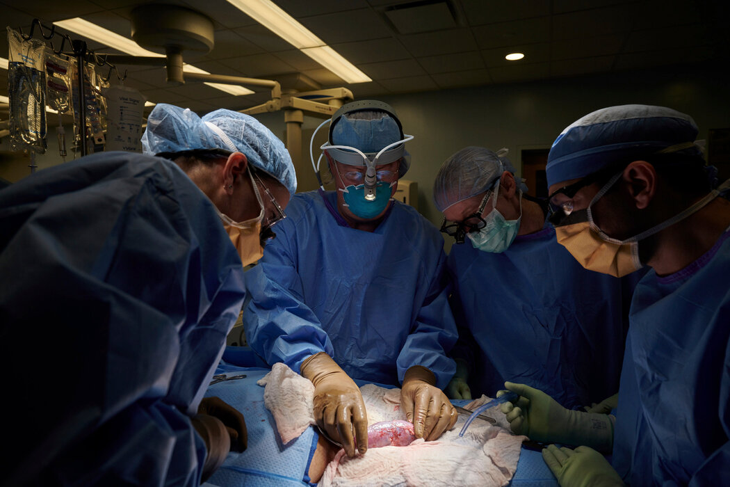 纽约时报双语：猪肾脏移植人体首次成功，或将突破器官供应难题